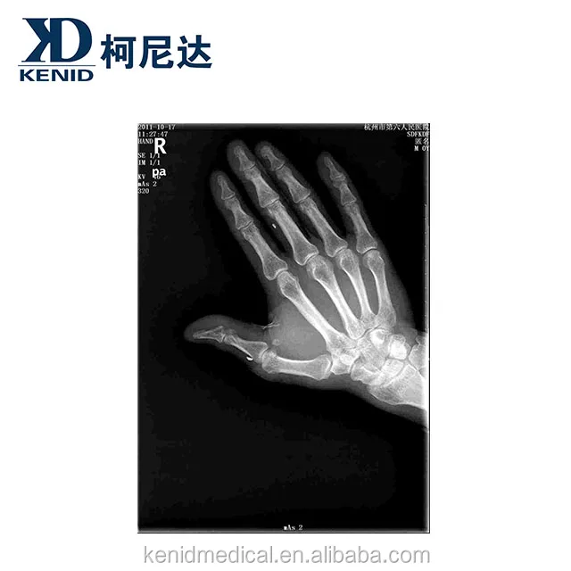 fuji-di-hl xray-1.jpg