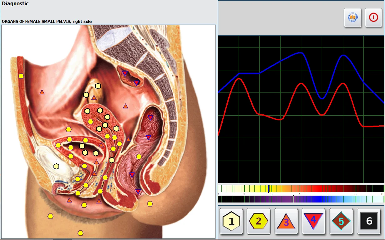 2021 Latest Professional 2 in 1 Touch Screen Metatron NLS Metapathia GR Hunter 4025