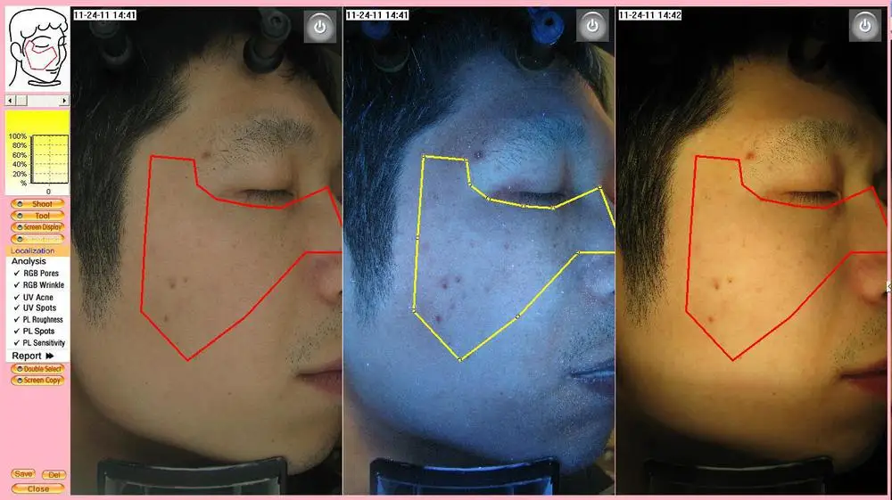 Professional skin analyzer / testing machine skin analysis device price with medical CE