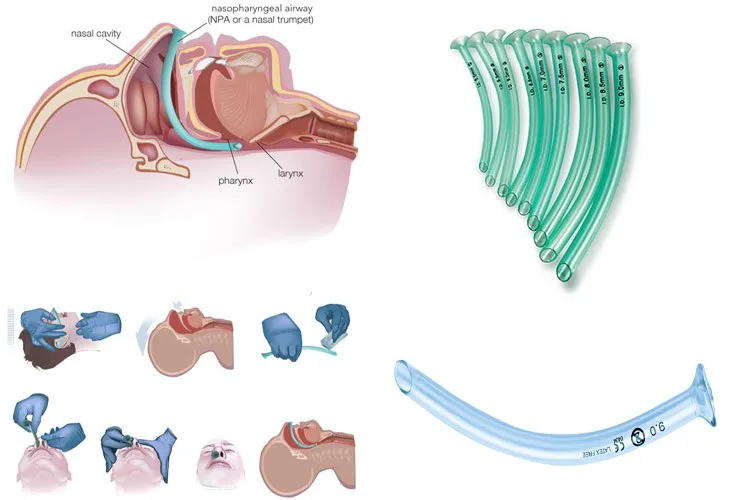 nasal-hose-pvc-nasopharyngeal-airway-buy-pvc-nasopharyngeal-airway