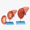 Human Kidney Model