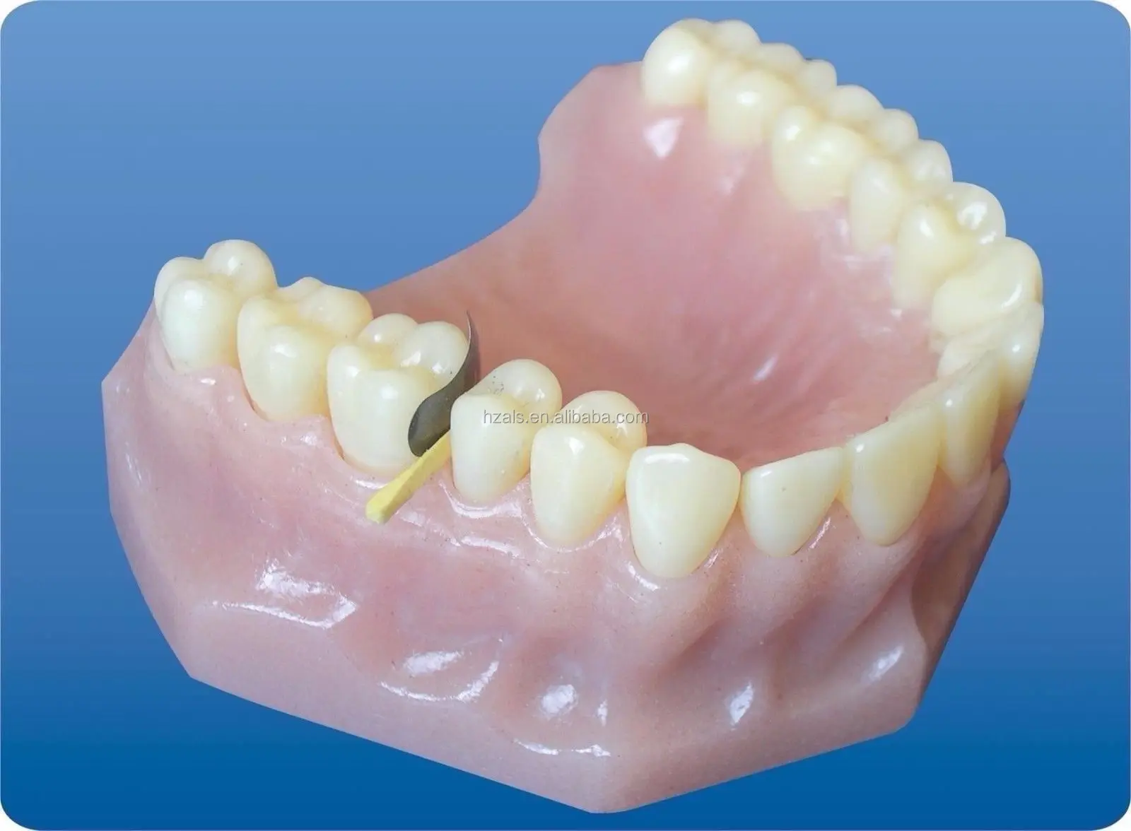 100 Pcs 35 Um Hard Sectional Matrix Band/contoured Matrix Bands/dental