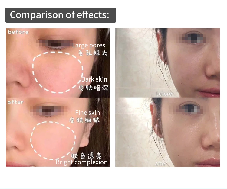 radar line carver (7).jpg