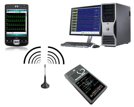 
Real-time Cardiovision Telemetry ECG Monitor multi-beds ECG Cardiac Rehab 