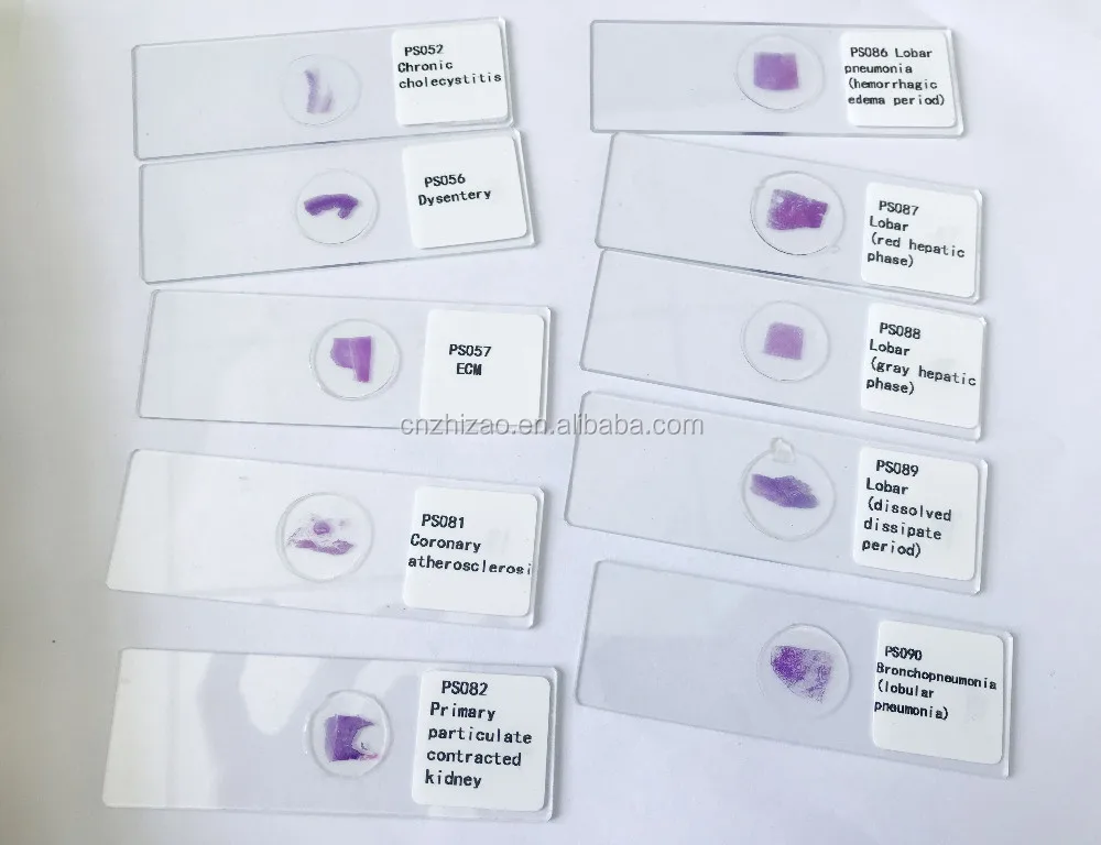 Humanos Individuales Sistema Patologia Preparado Portaobjetos De Microscopio De Humanos De Patologia Buy Juego De Diapositivas Para Microscopio Preparado Juego De Diapositivas Para Microscopio Preparadas Para Patologia Juego De Diapositivas Para