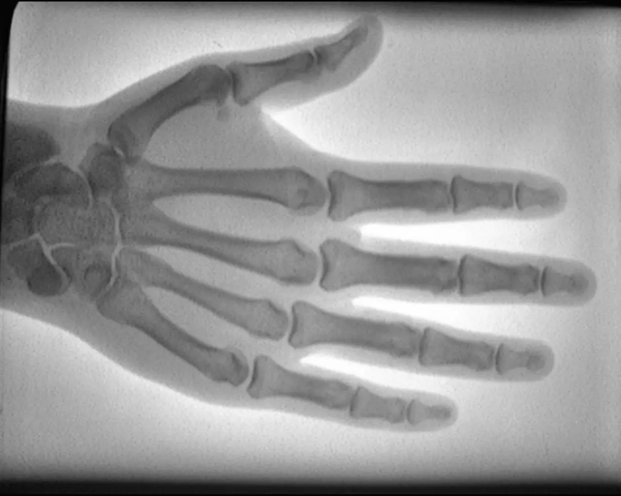 LCD Low-Intensity Portable X-Ray Imaging Scope