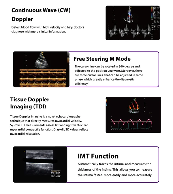 Ultrasonidos Ecografo 3d 4d Best Price Chison Q9 Digital Portable Ultrasound Machine With Fda Ce Certificate