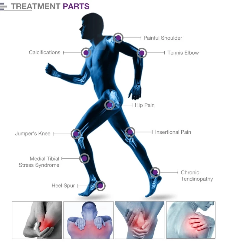 SW9 shockwave/waveshock shock wave physical therapy health center therapeutic machine
