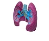 Full size model of the diseased lung,Lung pathologies anatomical model