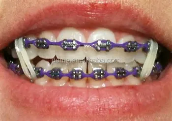 orthodontic rubber