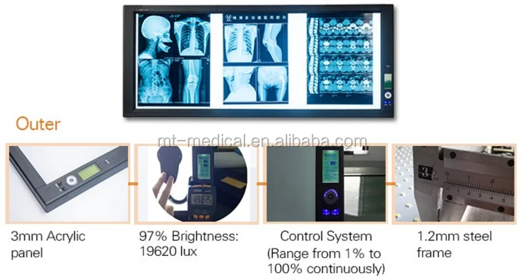 Medical LED Xray Viewer Negatoscope Xray Price for Sale