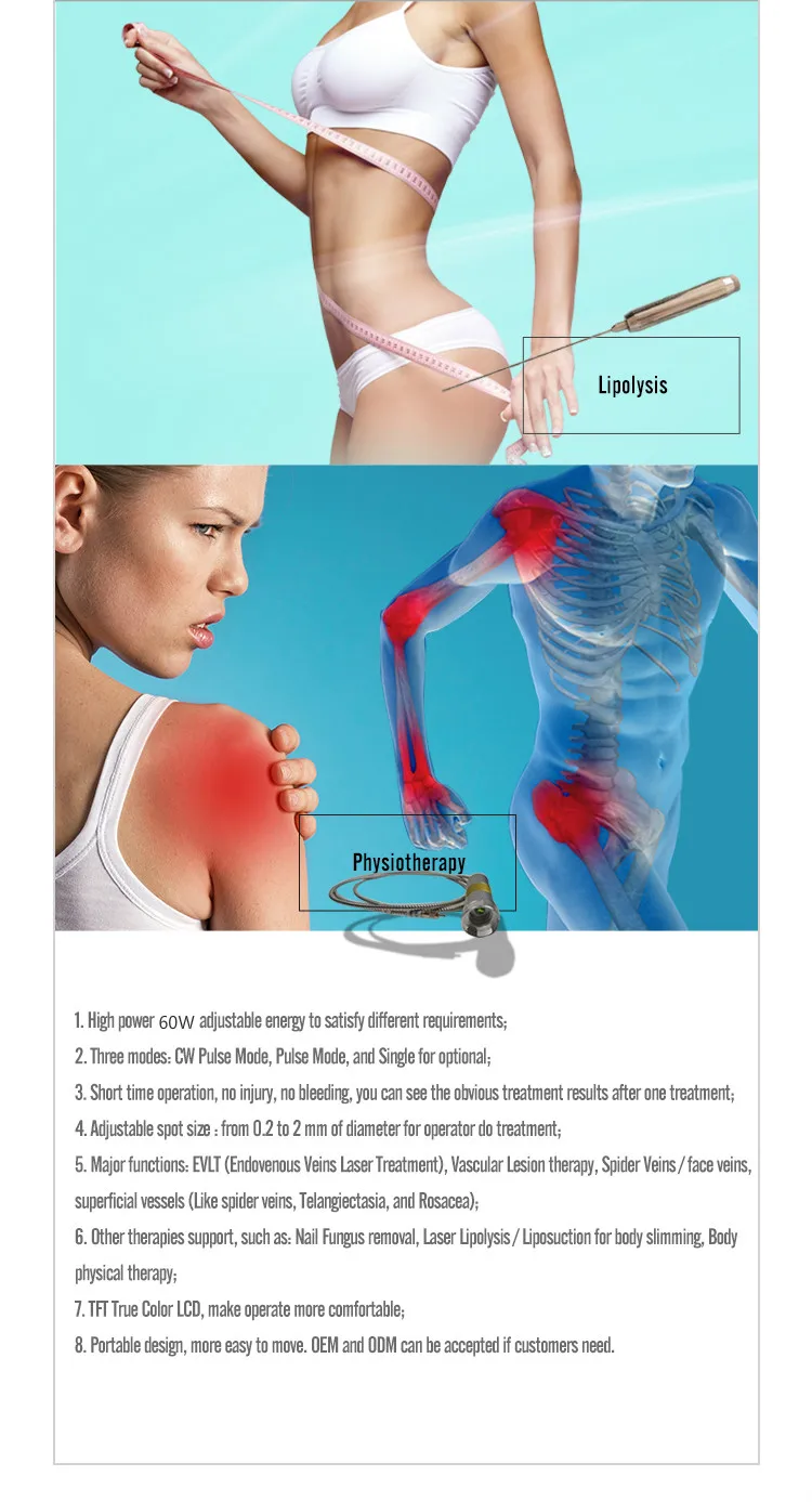 Nail Fungus Laser Treatment