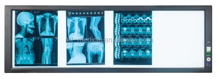 Most New models of ultrathin LED x-ray film viewer for public use and special for hospital
