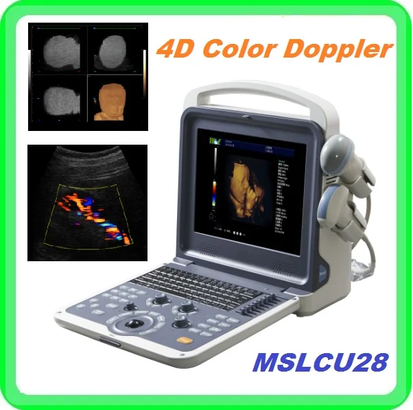 Portable Ergonomic Design 4d Ultrasound Machine Price Intelligent Built