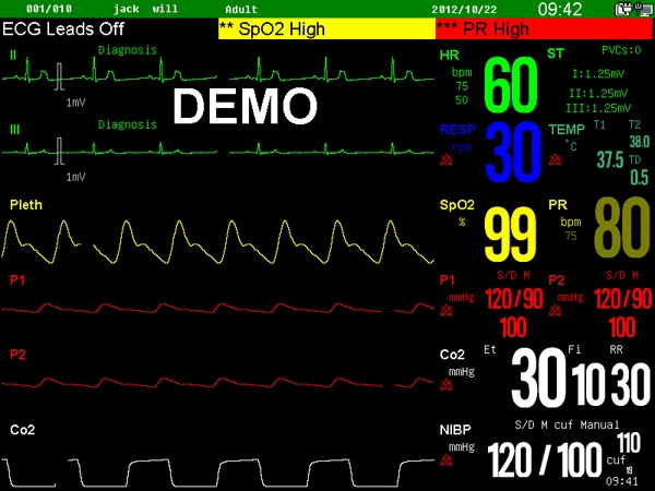 power:          ac 100-240,50/60hz patient range:    neonate