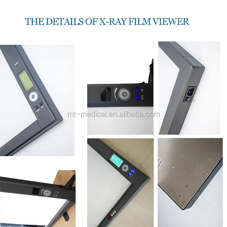 Medical Device Negatoscope Single X-ray Film Scanner