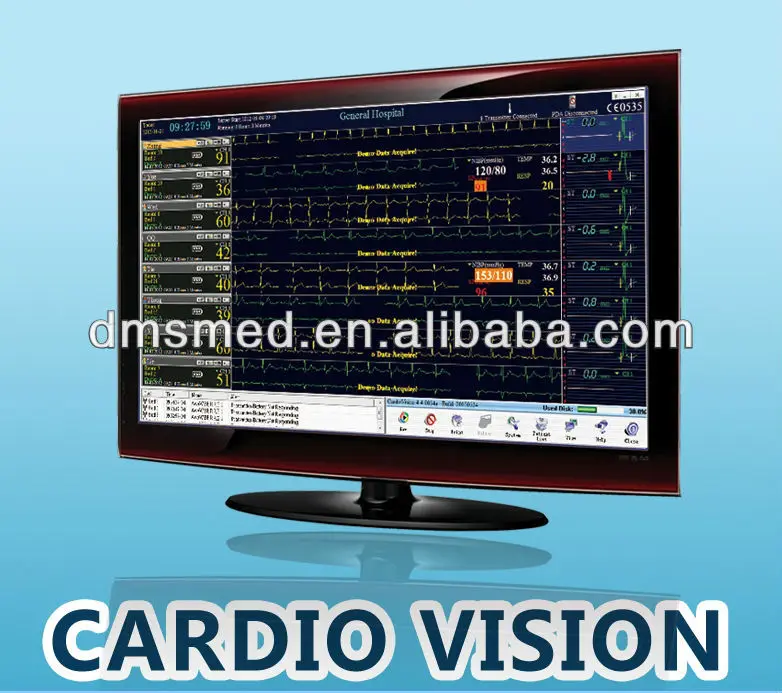 Cardiovision