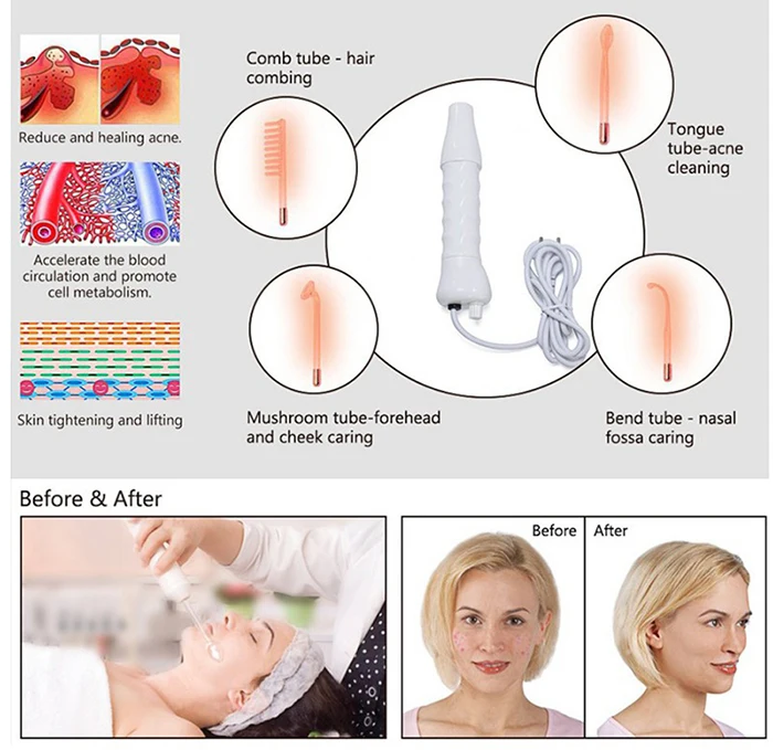 Hand hold Anti Hair Loss Equipment Electrodes High Frequency Facial Machine