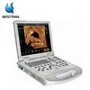 BT-UDC60PLUS 4D portable Laptop color doppler pregnancy diagnostic system medical digital echography ultrasound machine price