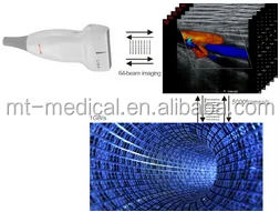 Portable Ultrasonic Diagnostic Devices Type Ultrasound Machine For Pregnancy