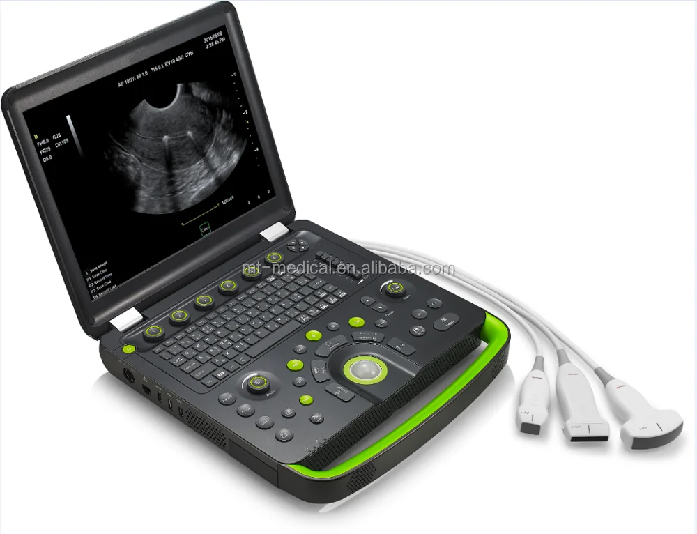Portable Ultrasonic Diagnostic Devices Type Ultrasound Machine For Pregnancy