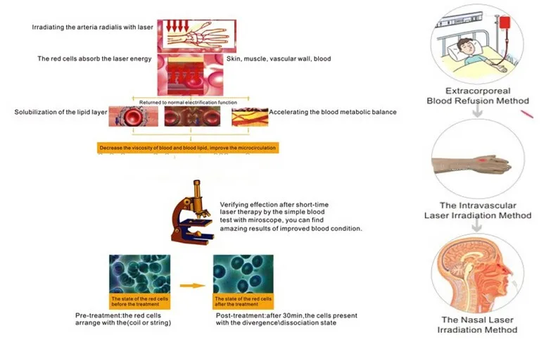 Onlineamericanstore Healthcare Laser Watch As A Gift For Parents Accessories -Online American Store