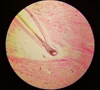 biology histology prepared slides of Skin of Human (show hair follicle) for microscopes