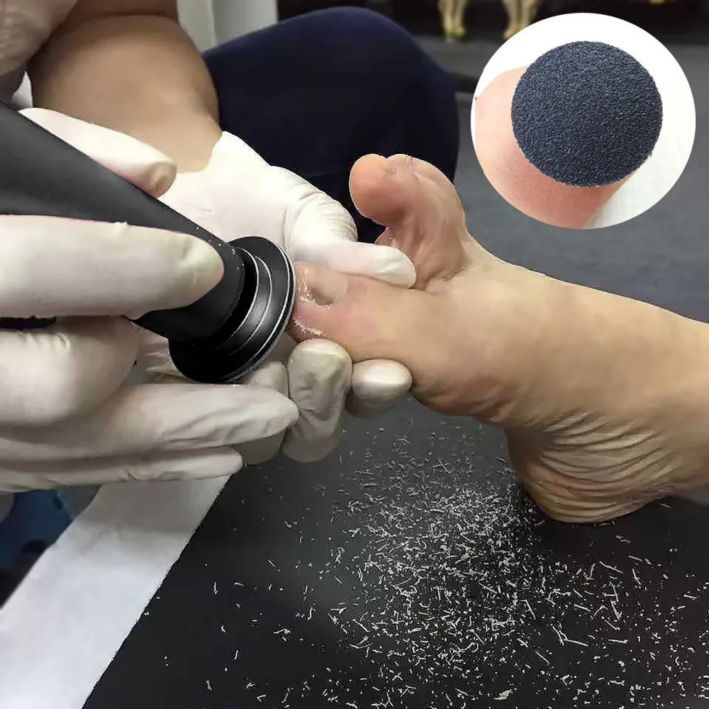 Foot File Sandpaper Discs Pedicure Tool For Dry Cracked Dead Skin On