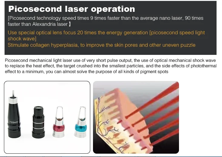 nd yag laser machine.png