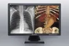12(JUSHA-C43) 4MP Dual-screen Color Medical Display, x ray scanner computer