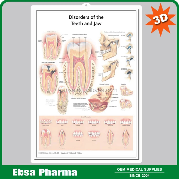 3d Medis Anatomi Manusia Dinding Grafik Poster Gangguan Gigi Dan Rahang Buy 3d Grafik Anatomi Manusia Dinding Poster Gangguan Dari Gigi Dan Rahang Product On Alibaba Com