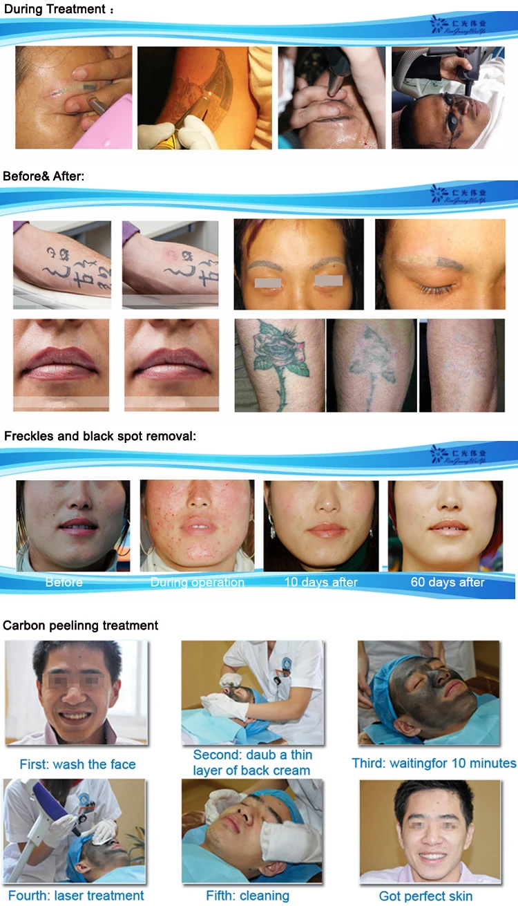 190 before and after.jpg