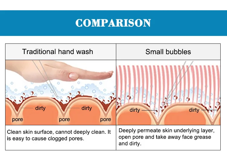 microdermabrasion machine