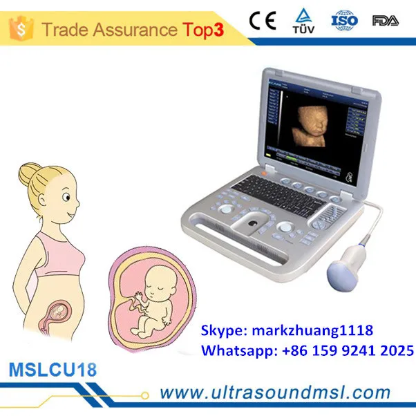 Mslcu18z Portable 4d Ultrasound Machinecheapest Price 4d Ultrasound