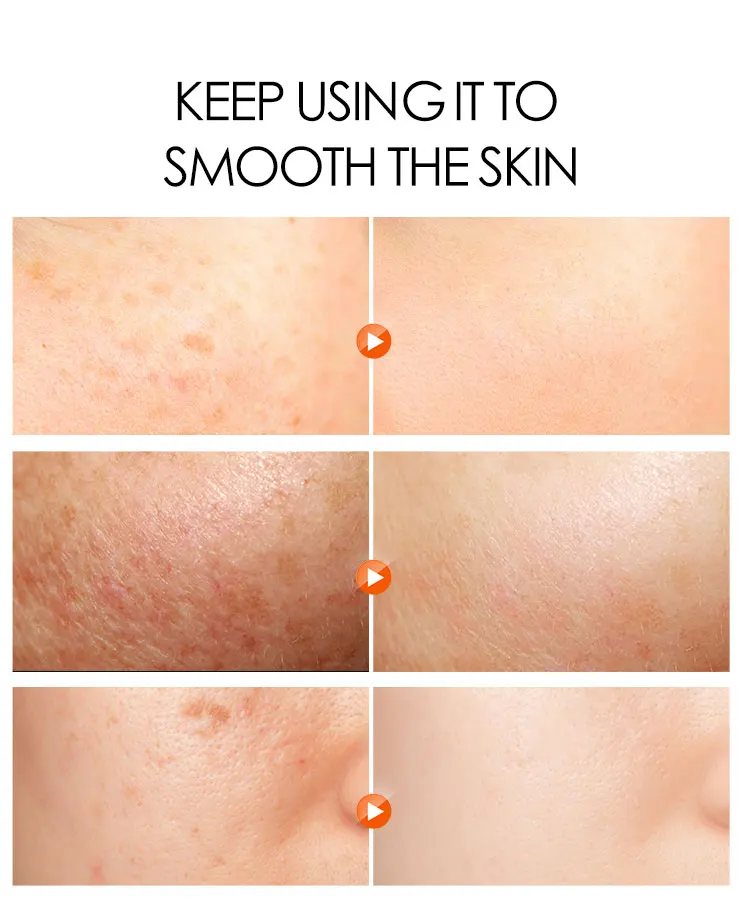 DR.RASHEL Abrutin Niacinamide Nourish Repair Fade Spots Night Cream Skin Whitening Cream