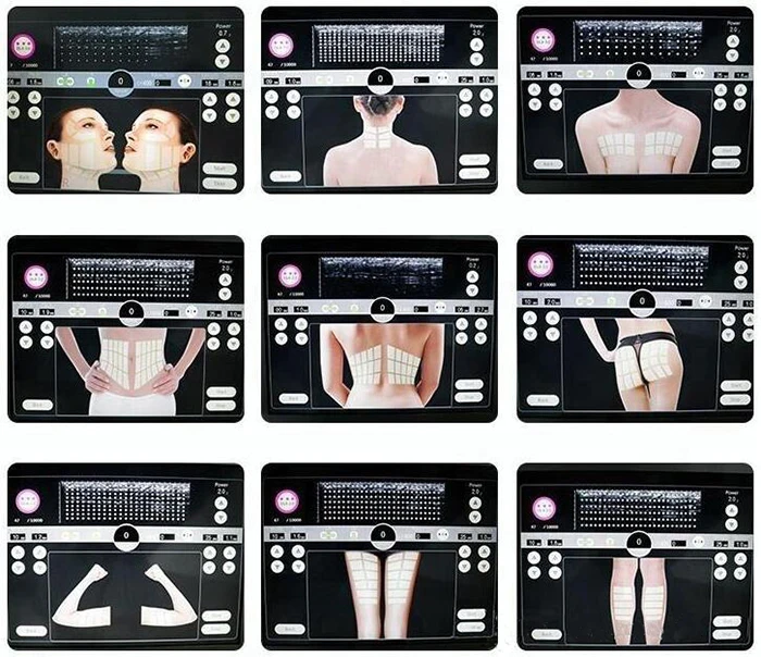 2021 Best Hifu Focused Ultrasound Face Lifting / Body Slimming 3D Hifu Machine