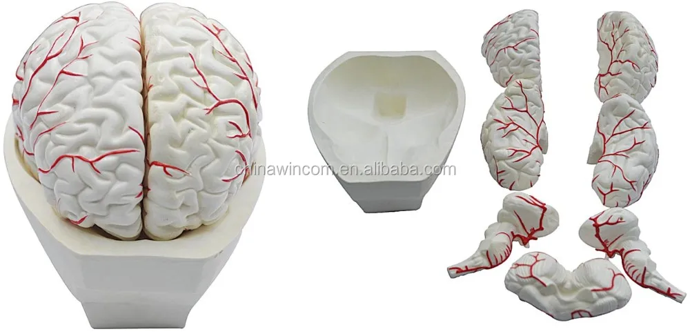 brain artery model,model of brain artery,brain artery