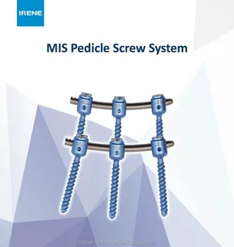 Mis Columna De Invasión Sistema Columna Tornillo Implantes Ortopédicos Mis Columna Buy Columna Miscolumna Tornillo Canulamosimplantes Ortopédicos - 