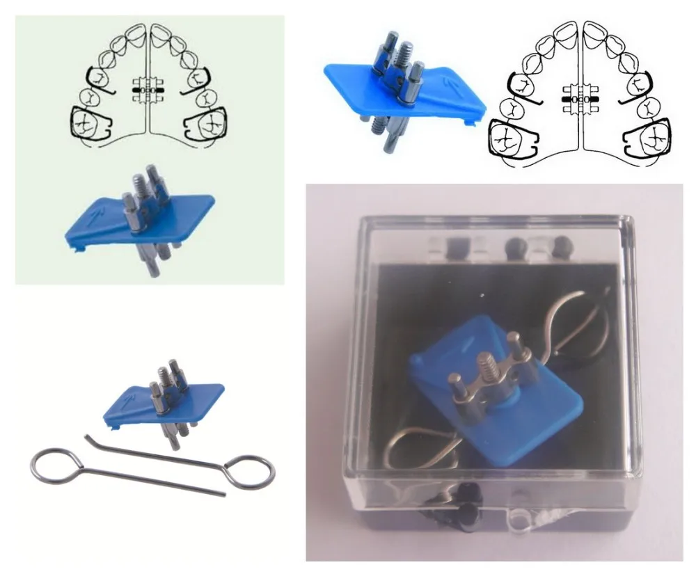 Dental Expansion Screw,Orthodontic Hyrax Screw With High Quality