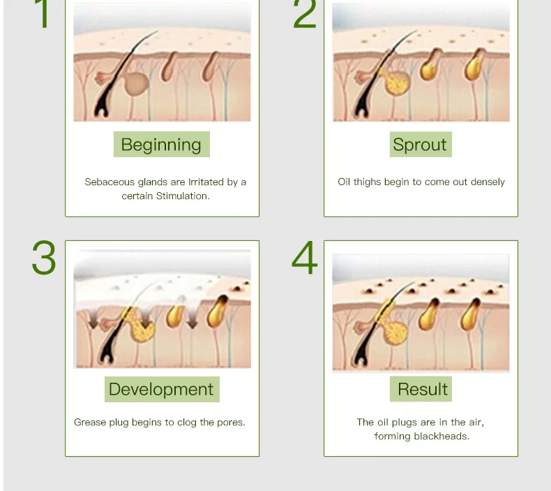 2018 cheap actived carbon Black Head EX Pore Strip Black head Remover