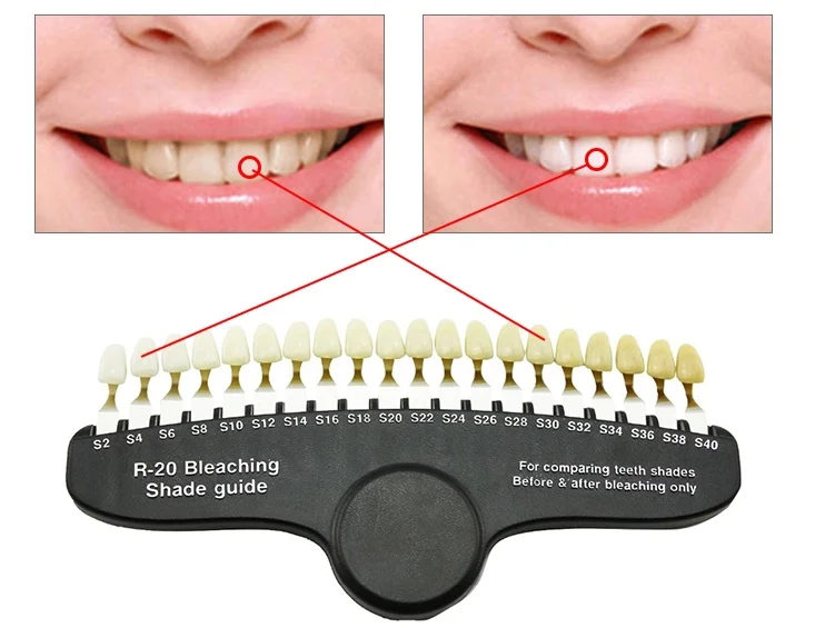 Teeth Whitening Shade Guide Professional Dental Shade ...