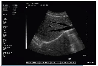 Full-digital B/W Laptop Ultrasound Scanner machine