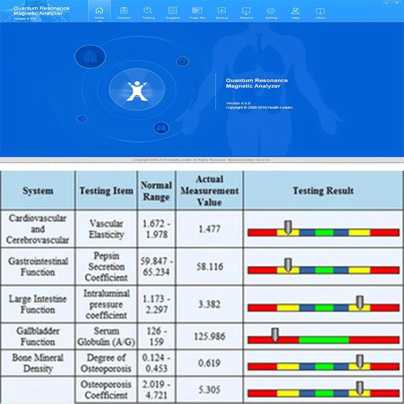 quantum magnetic resonance analyzer