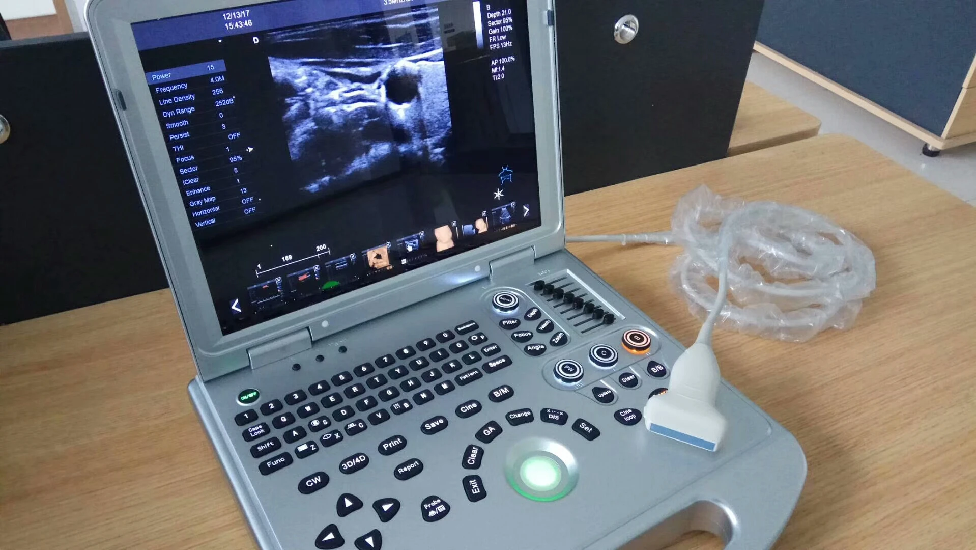 3d4d Portable Color Doppler Echocardiography Cardiac Machine