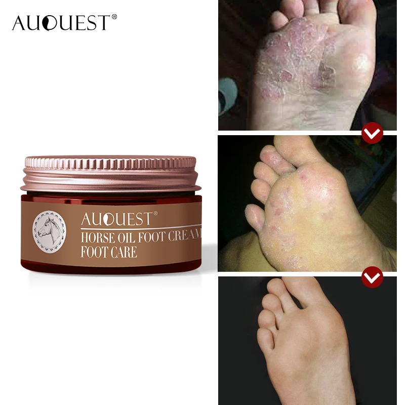 feet cream