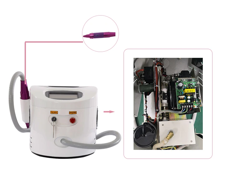 Rg196 High Energy Dermatology Laser Machine Portable Ce Q Switched Nd