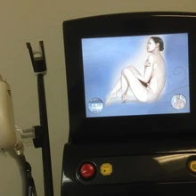 سريع في الحركة ألما الليزر سوبرانو الجليد قبضة/ألما سوبرانو الجليد مقبض خدمة إصلاح