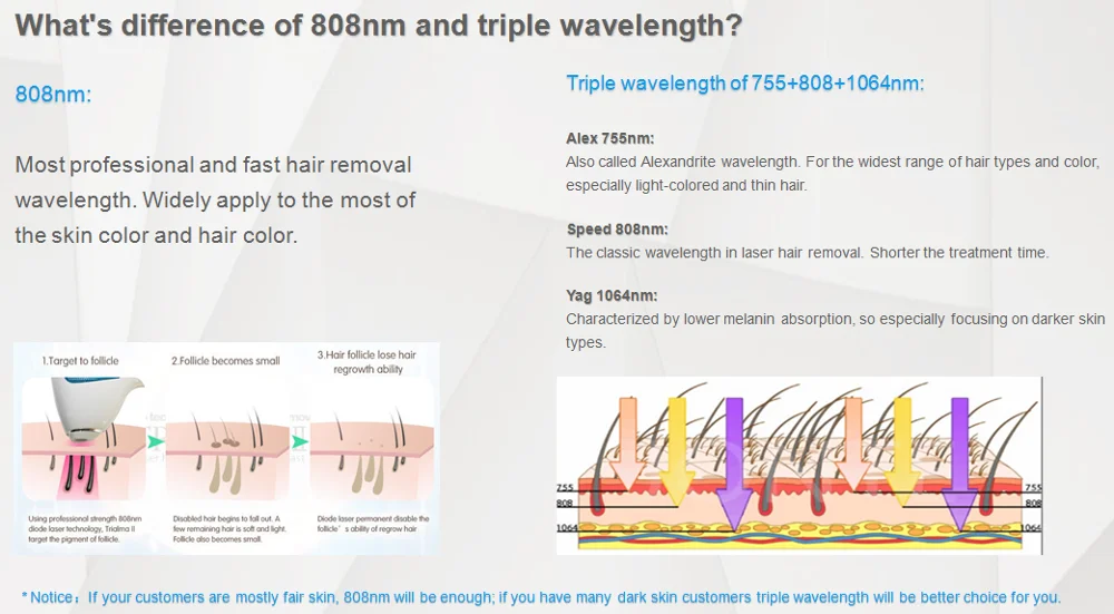 diode laser hair removal