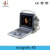 DCU9200H New general portable USG of 3D 4D color doppler diagnostic ultrasound scanner with 3d 4d software