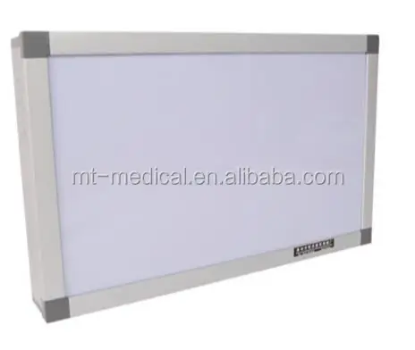 Negatoscope Double X-ray Film Viewer Price